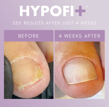 The GelBottle Hypofix™ 2-staps systeem